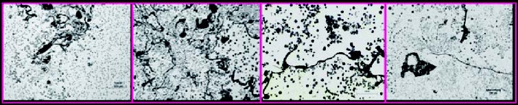 Chemical composition and some exemplifying micrographs of Dross inclusions.